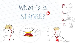 Stroke the Basics | STROKE ZONE GUIDE