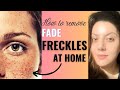 How to fade freckles on face naturally I Treatment for freckles on face #frecklestreatment