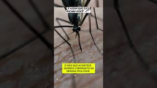 Picada do mosquito da dengue 🦟 #curiosidades #mosquito #dengue #ciencia