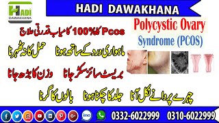 PCOS symptoms  | Polycystic ovary syndrome in urdu-Hindi/What is the Treatment of PCOS Ka Elaj