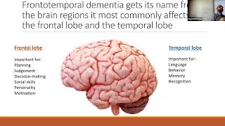 Frontotemporal Dementia: What we know and what we want to know