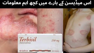 Terbisil tab uses Lamisil tab uses #Terbinafine