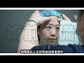 隱形提眉手術可讓你眉開眼笑 隱形提眉幫你告別眉壓眼 ｜林敬鈞醫師｜巨星整形外科