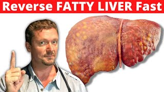 How Fast can KETO Reverse Fatty Liver? (Reverse NAFLD Fast)