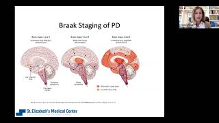 Sleep Matters: A Review of Sleep Issues in Parkinson's with Dr. Okeanis Vaou