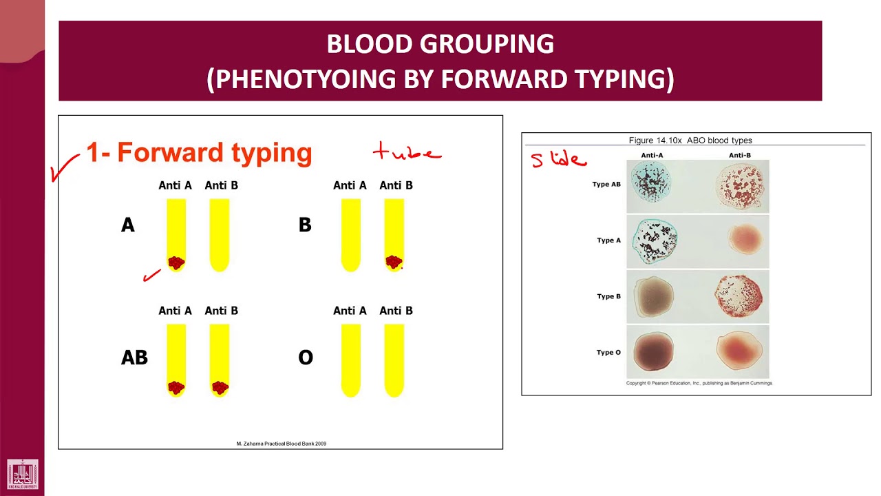 Hematology - 4 | U1-L24 | Forward Typing - YouTube