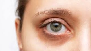 Decoding the Enigma: Unraveling the Psychopathic Stare Phenomenon