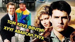 ТОМ КРУЗЫН “ТОП ГАН” ЭДГЭШГҮЙ ӨВЧТЭЙ ХҮҮГИЙН АМИЙГ АВАРСАН ГАЙХАМШИГТ ТҮҮХ