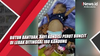 Butuh Bantuan, Bayi Kondisi Perut Buncit di Lebak Ditinggal Ibu Kandung