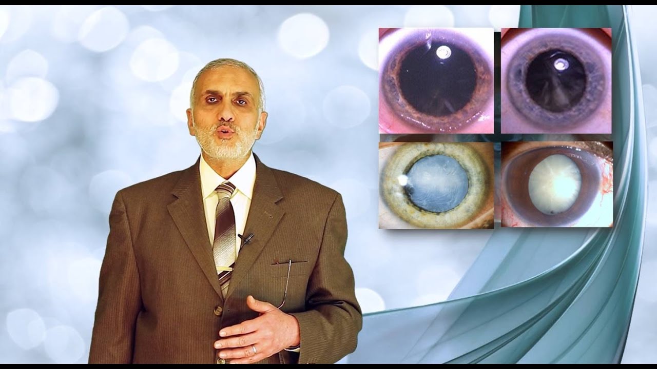 Elbromboly Basic Ophthalmology IC Lens Senile Cataract - YouTube