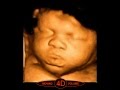 What is 4D ultrasound scan? What is 4D ultrasound scan?