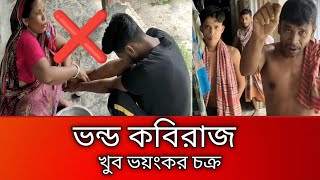 চুন ও পানি দিয়েই মিলবে জন্ডিস থেকে মুক্তি দাবি কবিরাজের কিন্তু ভন্ডামি ছাড়া আর কিছু না