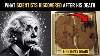 The Hidden Differences Between Einstein's Brain and a Normal Human Brain