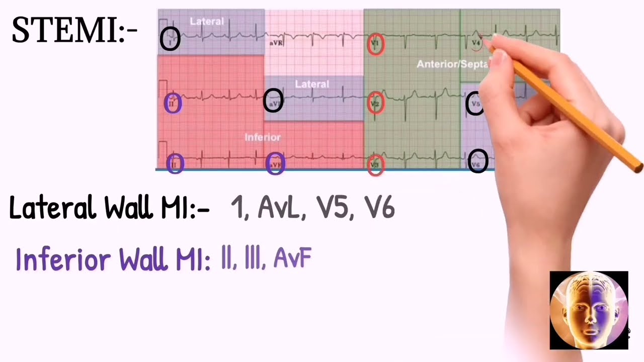 Steps To Read Ekg How To Read Ecg Interpretation Uljaa
