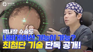 😲백내장 수술도 내비게이션 시대!