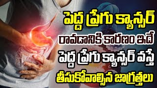 పెద్ద ప్రేగు క్యాన్సర్ రావడానికి కారణం ఇదే | Causes of Colon Cancer | CVR Health