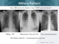 tb maybe not the differential diagnosis of tuberculosis