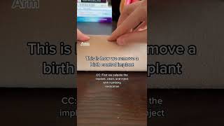 Nexplanon Part 6: REMOVAL #learnontiktok #tiktokpartner #nexplanon #birthcontrol #obgyn
