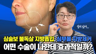 심술보 불독살 지방흡입, 심부볼 지방제거, 어떤 수술이 나한테 효과적일까?#피부노화#입꼬리처짐#지방흡입#심술보없애기#불독살없애기#마리오네트라인 #마리오네트주름