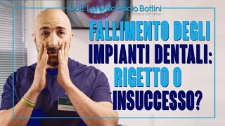 RIGETTO IMPIANTO DENTALE!