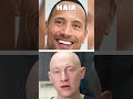 the rock s hair loss before going bald