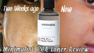 Minimalist PHA 3% + Biotic Toner Review after using for 1 month | Results after two weeks