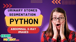 Python Image Processing project - Urinary Stones Segmentation in X-Ray Image - ClickMyProject