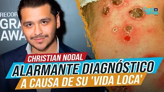 Christian Nodal recibe ALARMANTE diagnóstico médico a causa de su 'vida loca'