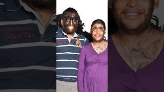 ప్రపంచం లోనే చాలా వింతైన కుటుంబం | World's Hairiest Family 👀#interestingfacts