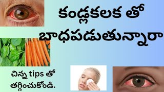 reducing eye infection  tips|| pink eye reduction ||కండ్లకలక కు చిట్కాలు