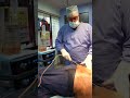 360 Abdominal Liposuction | Liposuction cost | Liposuction Surgery | Liposuction Video