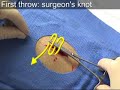 basic laceration repair