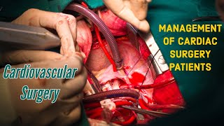 Coronary Artery Bypass Graft (CABG) Surgery I Surgical Management of CABG