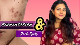 Acne Dark Spots || How to treat - Sradhapanigrahi || Odia