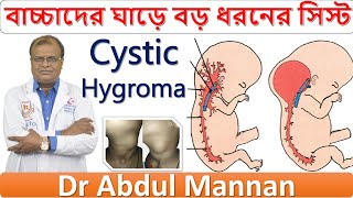 Cystic Hygroma । বাচ্চাদের ঘাড়ে বড় ধরনের সিস্ট । Best Homeopathic Doctor In Bangladesh।