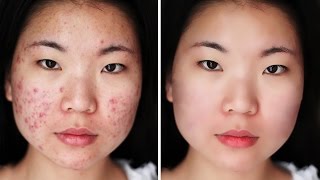 High-End Skin Softening in Photoshop | Remove Blemishes, Wrinkles, Acne Scars, Dark Spots (Easily)