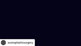 Darcey Silva and Stacey Silva twin transformation makeover at Avana Plastic Surgery with Dr.Abuzeni