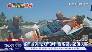 整隻腳在牠嘴裡! 衝浪卻遇鯊魚咬人 美國少女驚魂記｜TVBS新聞@TVBSNEWS01