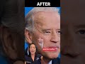 joe biden got plastic surgery surgeon reacts