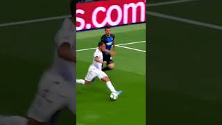 The injury ruined the Career of Eden Hazard