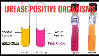 Urease-positive organisms