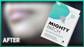 Mighty Patch Micropoint Review!