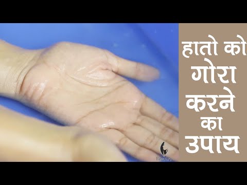 Fair Hands Home Remedies - In a Week (Hindi) Fair Hands Home Remedies - In a Week (Hindi)