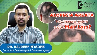 ALOPECIA AREATA & Triggers. How to prevent PATCHY HAIR LOSS? - Dr. Rajdeep Mysor