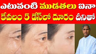 Skin Wrinkles | ఎటువంటి ముడతలు అయినా కేవలం 5 డేస్ లో దూరం | Dr Manthena Satyanarayana Raju Videos