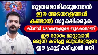 മൂത്രമൊഴിക്കുമ്പോൾ ഈ അടയാളങ്ങൾ കണ്ടാൽ സൂക്ഷിക്കുക കിഡ്‌നി രോഗങ്ങളുടെ തുടക്കമാണ്