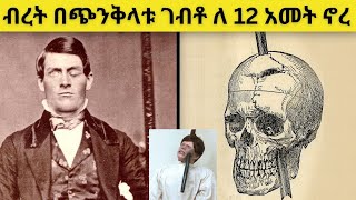 🔴ለማመን በሚከብድ ተአምር ከሞት የተረፉ ሰዎች | ebs | besntu | kana | seifu | ethiopian movie