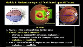 Module 5: Understanding Visual Fields from OCT Scans