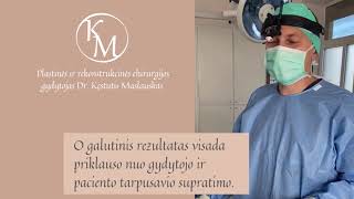 Plastinės chirurgijos gydytojas Dr  Kęstutis Maslauskas ruošiasi plastiinei operacijai