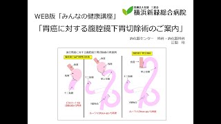 胃癌に対する腹腔鏡下胃切除術のご案内